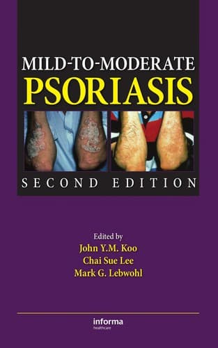 Tapa de Mild-to-moderate psoriasis