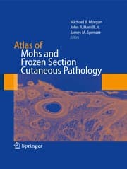 Tapa de Atlas of Mohs and frozen section cutaneous pathology