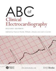 Tapa de ABC of clinical electrocardiography