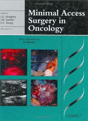 Tapa de Minimal access surgery in oncology
