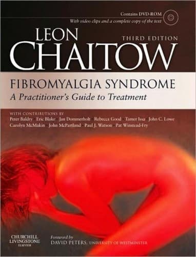 Tapa de Fibromyalgia syndrome