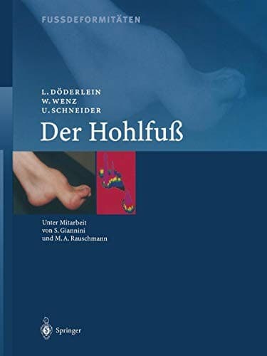 Tapa de Fussdeformitäten