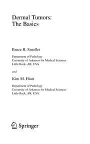 Tapa de Dermal Tumors: The Basics