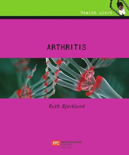 Tapa de Arthritis