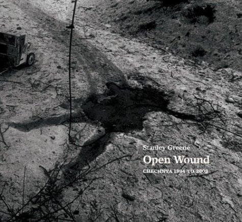 Tapa de Open wound