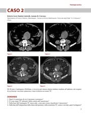 Tapa de Imaging nelle urgenze vascolari — Body