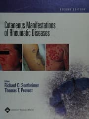 Tapa de Cutaneous manifestations of rheumatic diseases