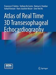 Tapa de Atlas of Real Time 3D Transesophageal Echocardiography