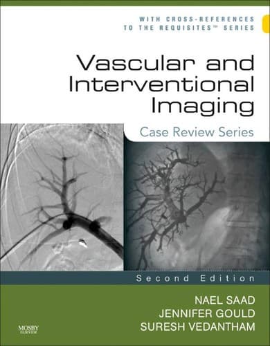 Tapa de Vascular and interventional imaging