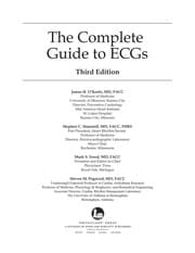 Tapa de The complete guide to ECGs
