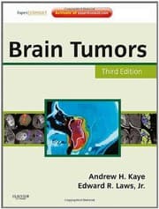 Tapa de Brain tumors