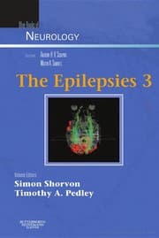 Tapa de The epilepsies 3