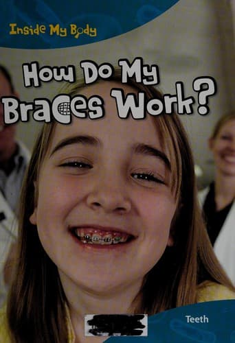 Tapa de How do my braces work?