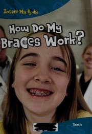 Tapa de How do my braces work?