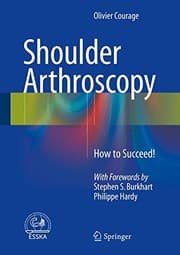 Tapa de Shoulder Arthroscopy