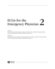Tapa de ECGs for the emergency physician 2