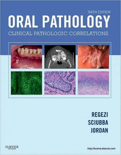 Tapa de Oral pathology