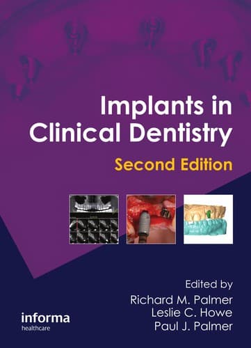 Tapa de Implants in clinical dentistry