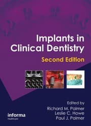 Tapa de Implants in clinical dentistry