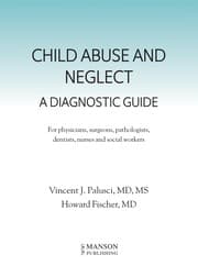Tapa de Child abuse and neglect