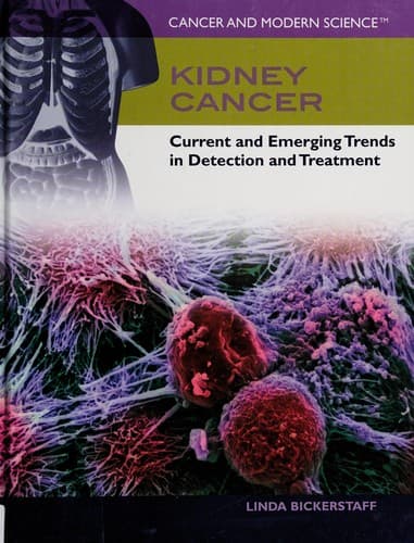 Tapa de Kidney cancer