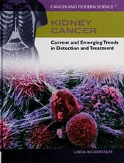 Tapa de Kidney cancer