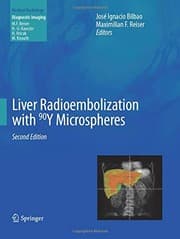 Tapa de Liver Radioembolization with 90Y Microspheres