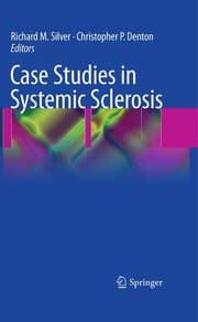 Tapa de Case studies in systemic sclerosis