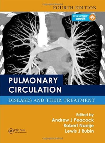 Tapa de Pulmonary circulation