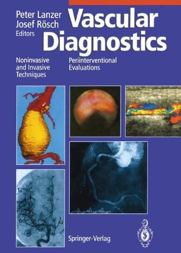 Tapa de Vascular Diagnostics
