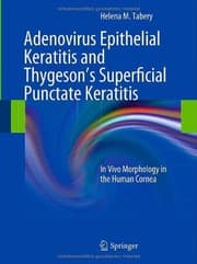 Tapa de Adenovirus epithelial keratitis and Thygeson's superficial punctate keratitis