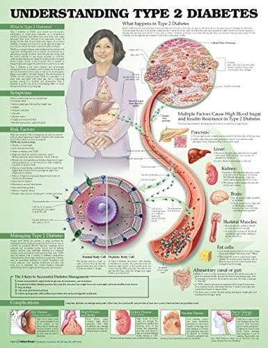 Tapa de Understanding Type 2 Diabetes Anatomical Chart