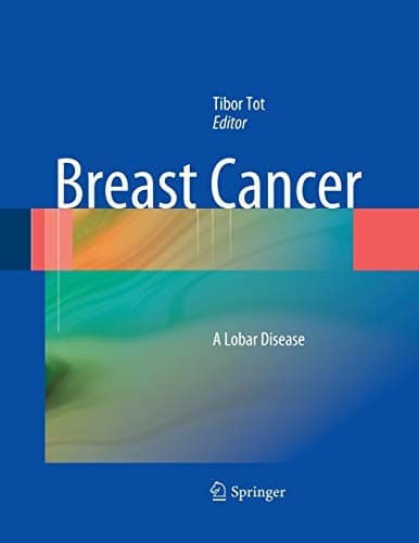 Tapa de Breast Cancer