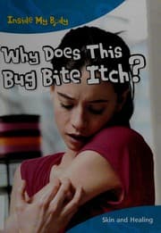 Tapa de Why does this bug bite itch?