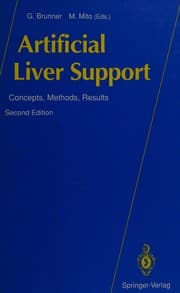 Tapa de Artificial liver support