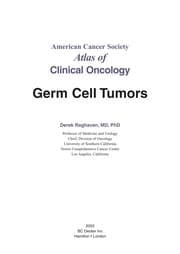 Tapa de Germ cell tumors