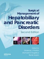 Tapa de Surgical management of hepatobiliary and pancreatic disorders