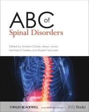 Tapa de ABC of spinal disorders