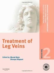 Tapa de Treatment of leg veins