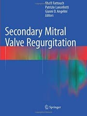 Tapa de Secondary Mitral Valve Regurgitation