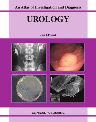 Tapa de Urology