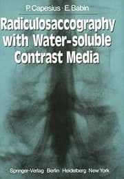 Tapa de Radiculosaccography with Water-soluble Contrast Media
