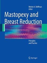 Tapa de Mastopexy and Breast Reduction