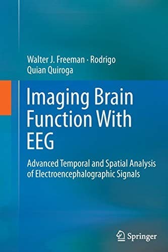 Tapa de Imaging Brain Function With EEG