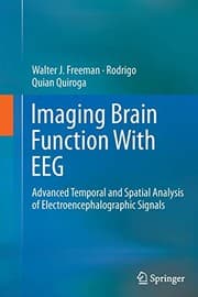 Tapa de Imaging Brain Function With EEG