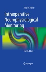 Tapa de Intraoperative neurophysiological monitoring