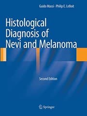 Tapa de Histological Diagnosis of Nevi and Melanoma