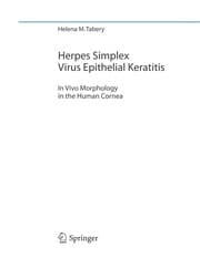 Tapa de Herpes simplex virus epithelial keratitis