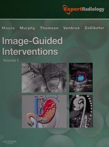 Tapa de Image-guided interventions