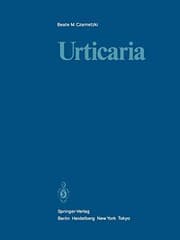 Tapa de Urticaria